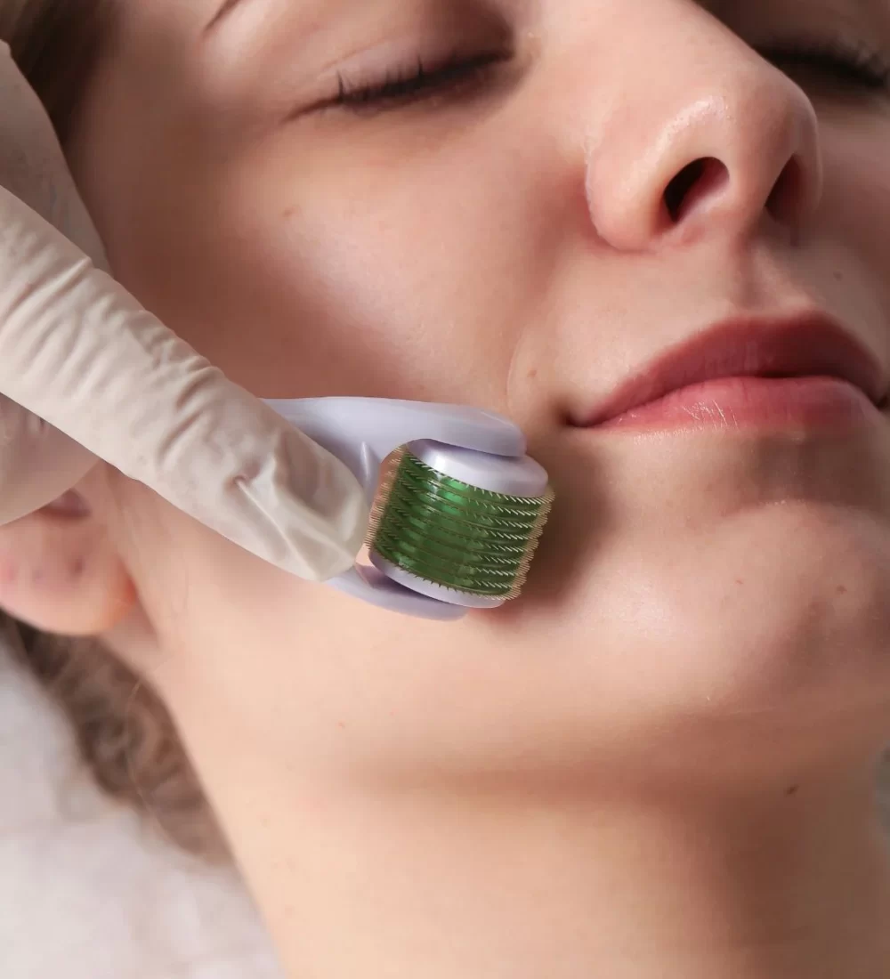 DERMA ROLLER dr estetica2